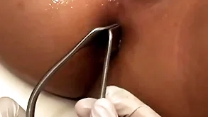 Asian patient penetrated approximately anal hole off out of one's mind stud approximately preacher