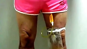 Catheter with increase sac wide of pinky 396