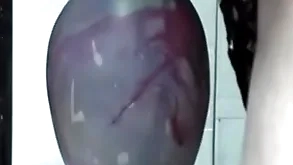 Huge stick in gapes his ass