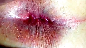 Arse coupled with anus closeup